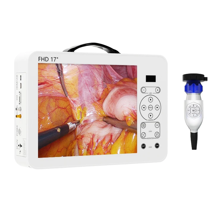 17 Zoll HD Video-Otoskop HNO-D – Medical Lab Images Bewertung und Preis